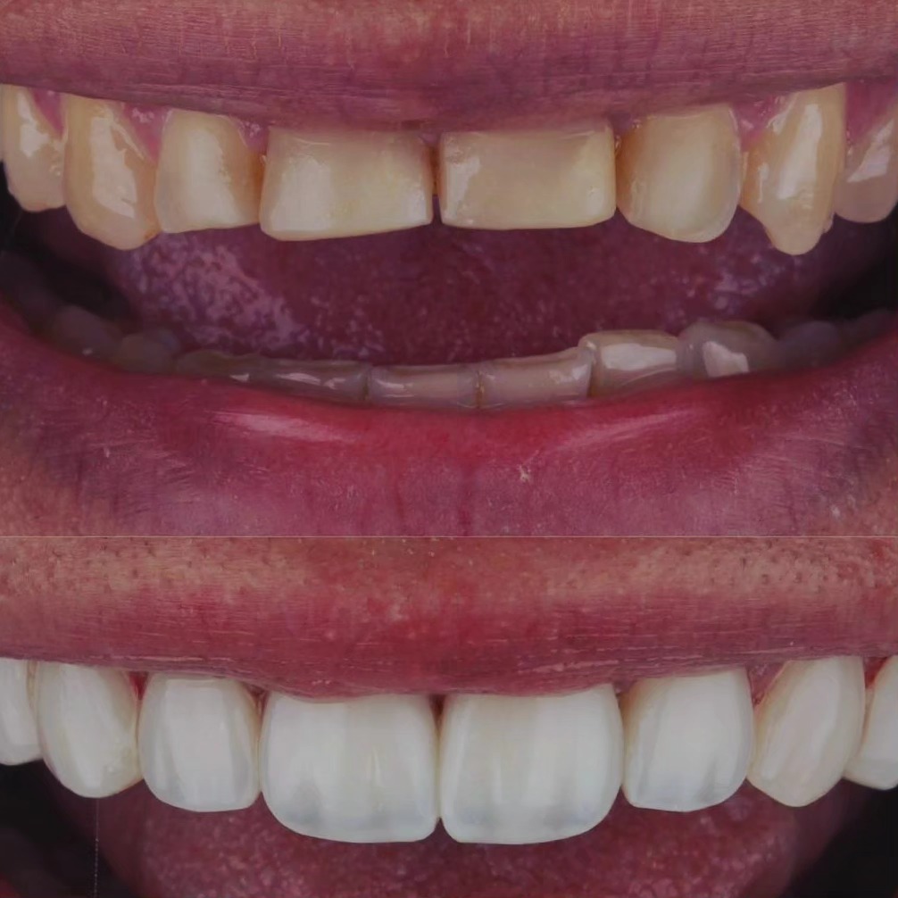 Transformação do Sorriso (antes e depois)